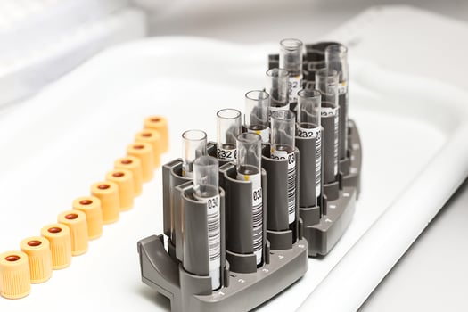 A chemical sample bottle. Centrifuge. A test tube vial sets for analysis. photo
