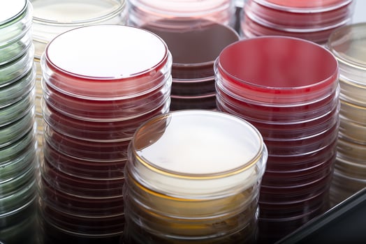 Red and brown petri dishes stacks in microbiology lab. Focus on stacks. photo