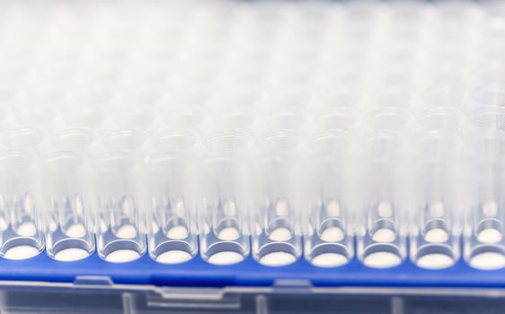 A set of glass tubes for samples. Laboratory chemical equipment. photo
