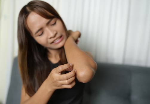 Asian woman has itching on her hands and arms. photo