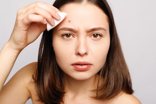 Portrait of young attractive woman touching her face and looking for acne photo