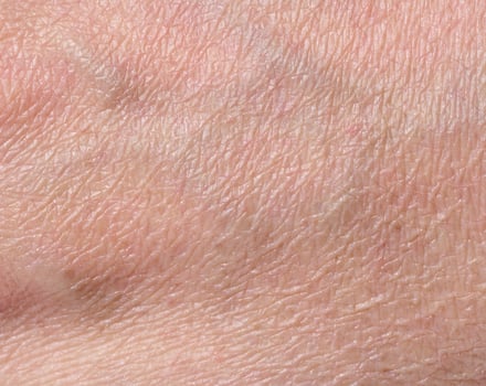 White person skin texture photo