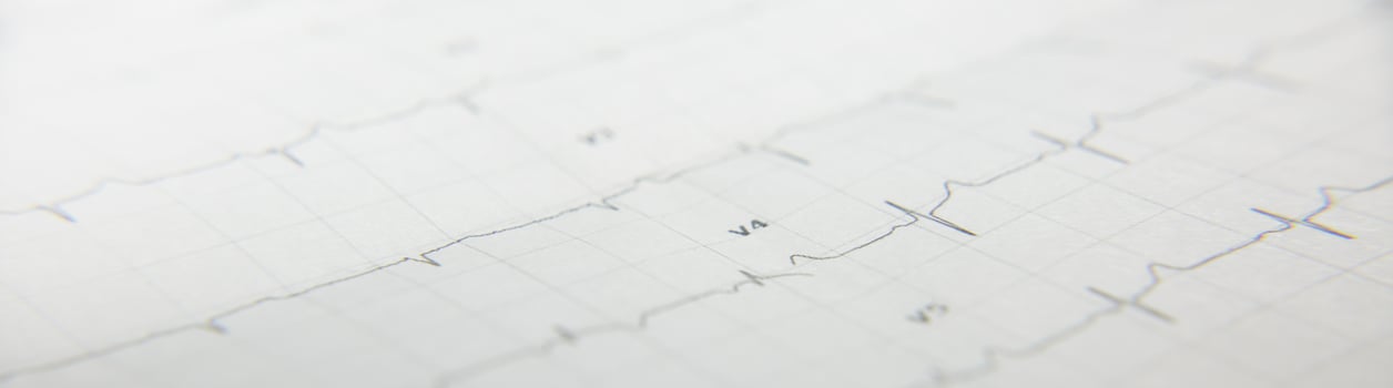 a card with a cardiogram of the heart. High quality photo