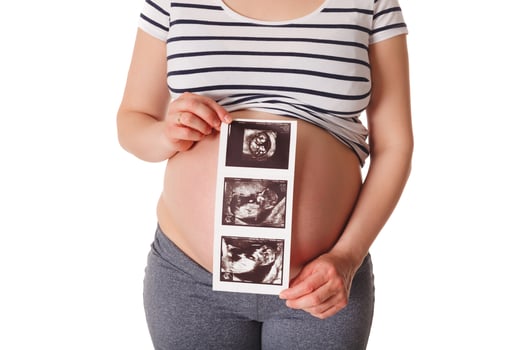 Pregnant woman standing and holding her ultrasound baby scan photo