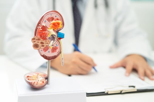 Kidney disease, Chronic kidney disease ckd, Doctor with human model to study and treat in hospital. photo