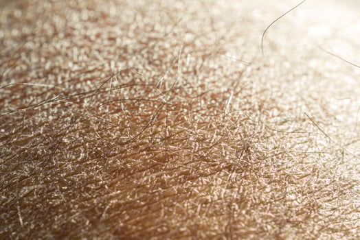 Closeup view of dry human skin . photo