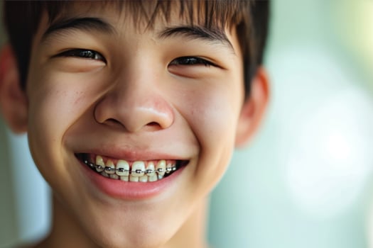 AI generated Teen Asian man with braces smiling mouth close up The concept of modern dentistry. Generative AI photo