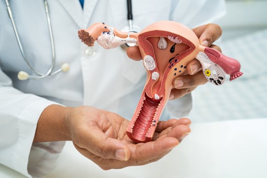 Uterus, doctor with anatomy model for study diagnosis and treatment in hospital. photo