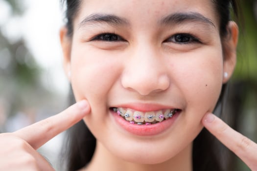 Portrait of a young asian woman with braces on her teeth photo