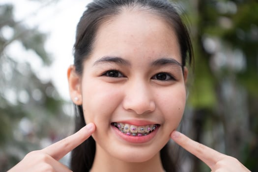 Portrait of a young asian woman with braces on her teeth photo