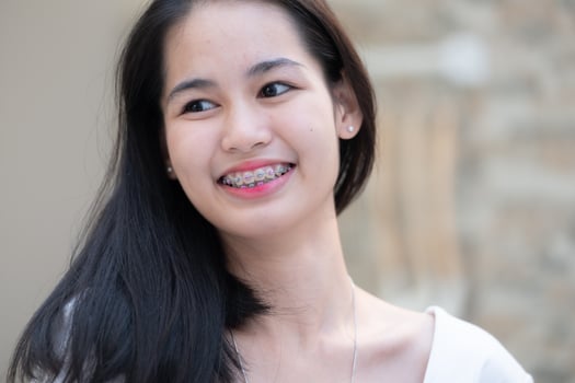 Portrait of a young asian woman with braces on her teeth photo