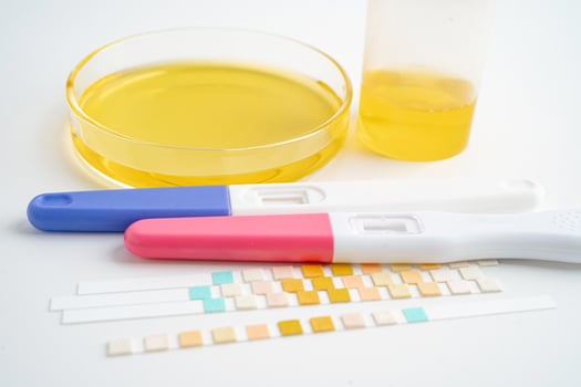 Urinalysis, pregnancy test and urine cup with reagent strip pH paper test in laboratory, contraception health and medicine. photo