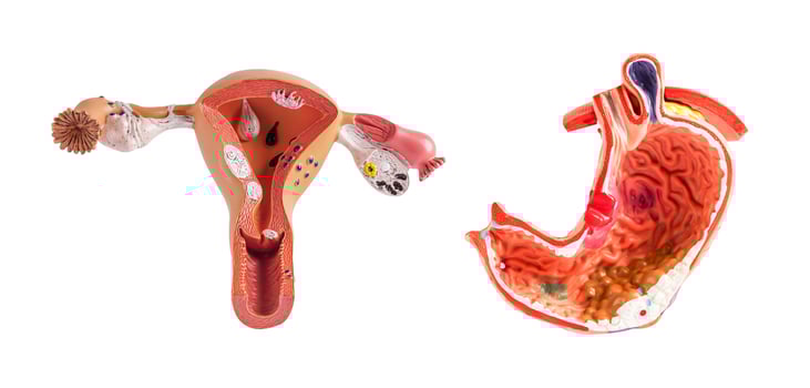Uterus and stomach model isolated on white background, doctor holding anatomy model for study diagnosis and treatment in hospital. photo
