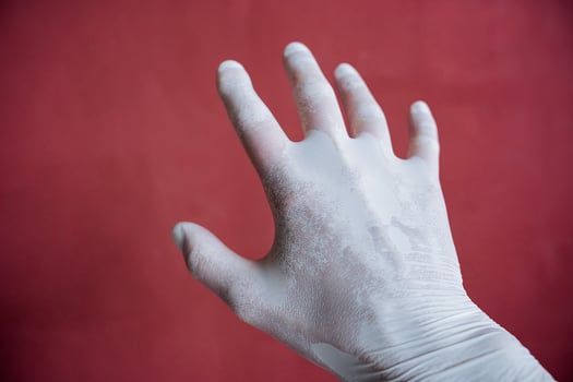 a hand in a white medical glove stretches forward, a sweaty hand under latex, fingers spread out against a maroon wall, hand protection photo