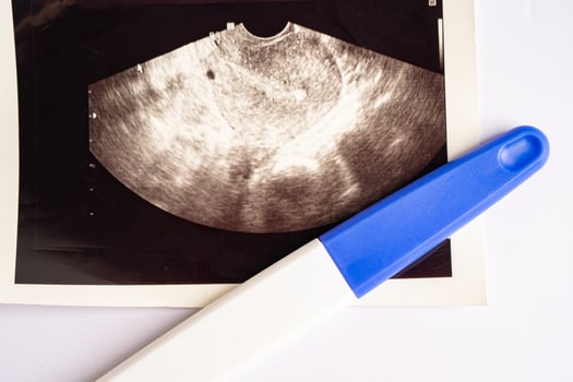 Pregnancy test with ultrasound scan of baby uterus, contraception health and medicine. photo
