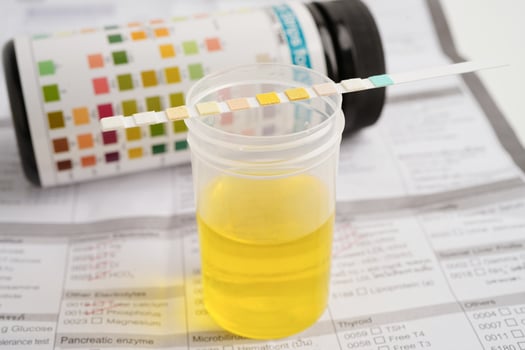Urinalysis, urine cup with reagent strip pH paper test and comparison chart in laboratory. photo