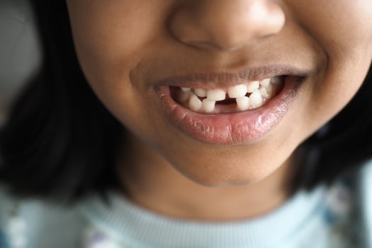 detail shot of child with teeth missing photo