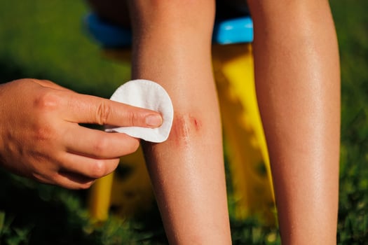 A woman's hand heals a child's wound below the knee. A child sits on a chair and green grass in the summer. Treatment of the wound. First aid. Close-up photo. photo