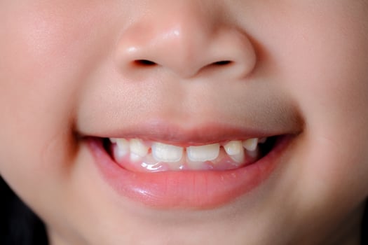 Close up of a cute Asian girl smiling happily showing her front teeth. Happy life concept photo