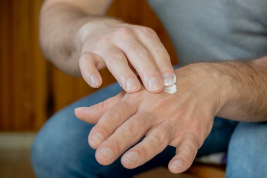 Hands of a man applying cream. photo