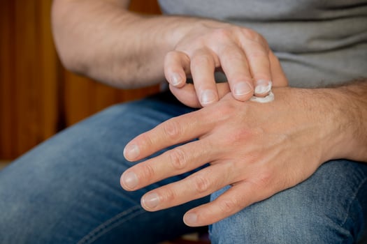 Hands of a man applying cream. photo