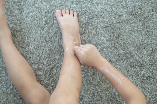 Little Asian boy's hands peeling off dry skin on his legs. Skin problems. photo