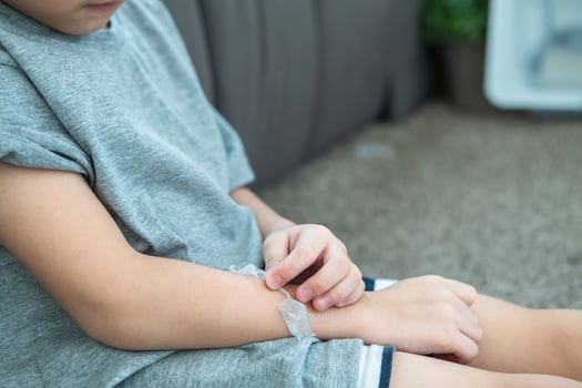 Little Asian boy's hands peeling off dry skin on his arm. Skin problems. photo