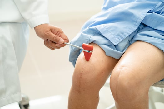 Asian doctor use hammer knock senior woman patient to check knee reflex, nerve and muscle in hospital. photo