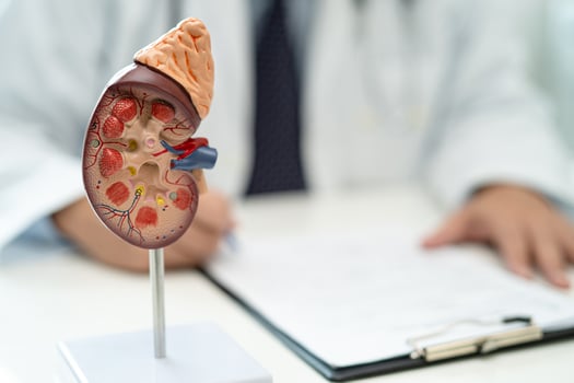 Kidney disease, Chronic kidney disease ckd, Doctor with human model to study and treat in hospital. photo
