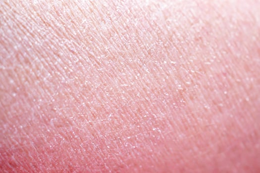 dry and dehydrated human skin texture background photo