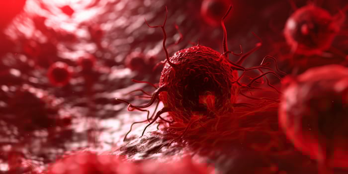 AI generated Horrible Red Cancer Cells Disease Spreading on an Organ inside Human Body. Cancer Treatment, Cancer Oncology, Growing Tumor Cells photo