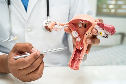 Uterus, doctor with anatomy model for study diagnosis and treatment in hospital. photo