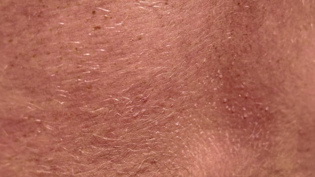 Human Skin Close Up, Pores and Hair photo