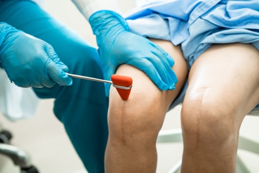 Asian doctor use hammer knock senior woman patient to check knee reflex, nerve and muscle in hospital. photo