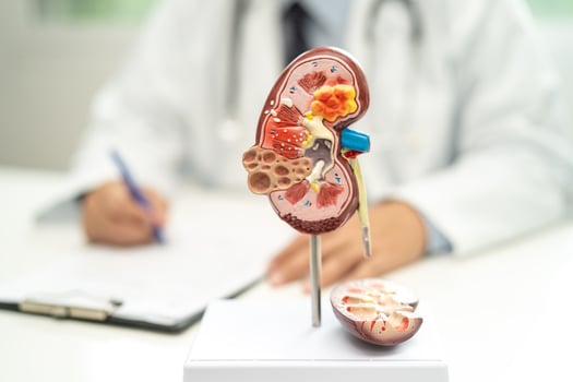 Kidney disease, Chronic kidney disease ckd, Doctor with human model to study and treat in hospital. photo