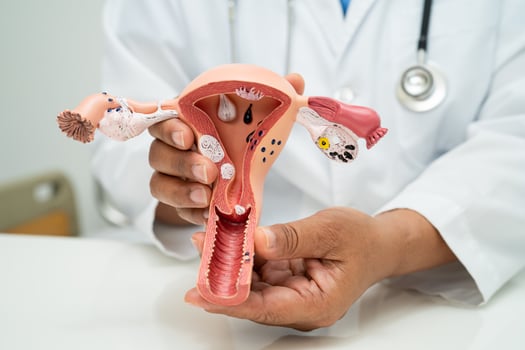 Uterus, doctor with anatomy model for study diagnosis and treatment in hospital. photo