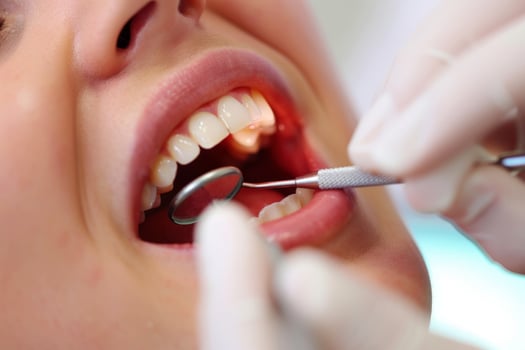 AI generated Dental treatment. Close up of female at dentist office, getting check up. Generative AI photo