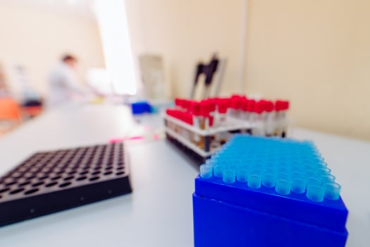 Tubes of blood sample for testing. Medical equipment. Blood test photo