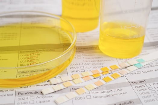 Urinalysis, urine cup with reagent strip pH paper test and comparison chart in laboratory. photo