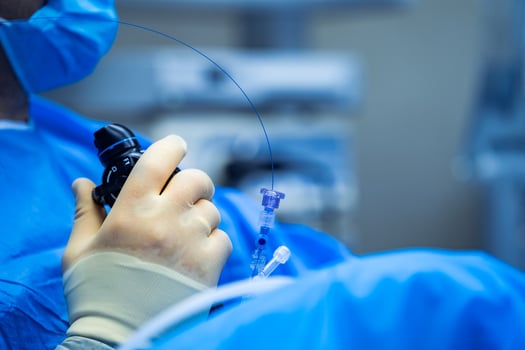 operating room for surgical venous vascular surgery clinic, selective focus on hand with probe. modern clinic and equipment. Closeup. photo