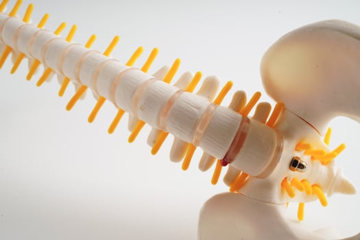 Spinal nerve and bone, Lumbar spine displaced herniated disc fragment, Model for treatment medical in the orthopedic department. photo