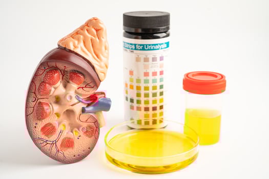Urinalysis, Kidney model and urine cup with reagent strip pH paper test and comparison chart in laboratory. photo