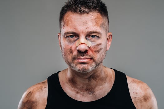 a battered man in a black T shirt who looks like a drug addict and a drunk stands against a gray background photo
