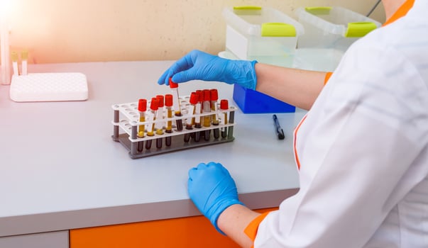 Test tubes with blood on a tray. Blood laboratory. Illness testing. Emergency testing. Virus infection. Pneumonia testing. COVID-19 and coronavirus identification. Pandemia. photo