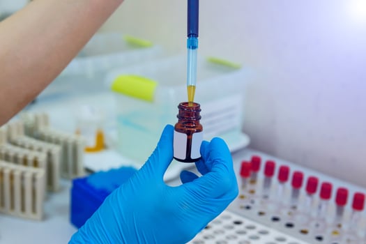 Testing in laboratory. Chemical research. Prevention. Pneumonia diagnosting. COVID-19 and coronavirus identification. Pandemia. Medicine dropper with blood. photo