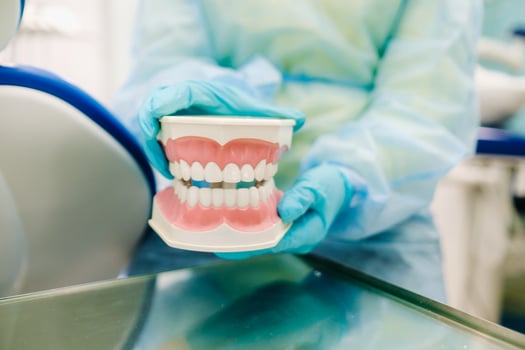 A model of a human jaw with teeth in the dentist's hand photo