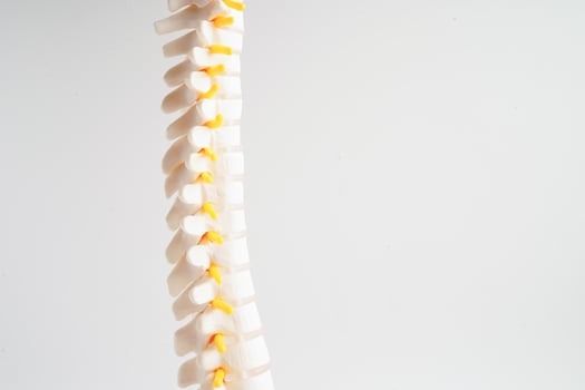 Spinal nerve and bone, Lumbar spine displaced herniated disc fragment, Model for treatment medical in the orthopedic department. photo