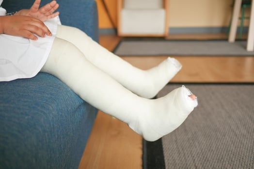 little child with plaster bandage on leg. photo