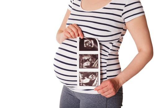 Pregnant woman standing and holding her ultrasound baby scan photo
