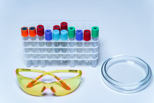 Photo of laboratory equipment. Empty test tubes with colored caps. Medical equipment together isolated on white background. Scientific equipment gadgets concept.
